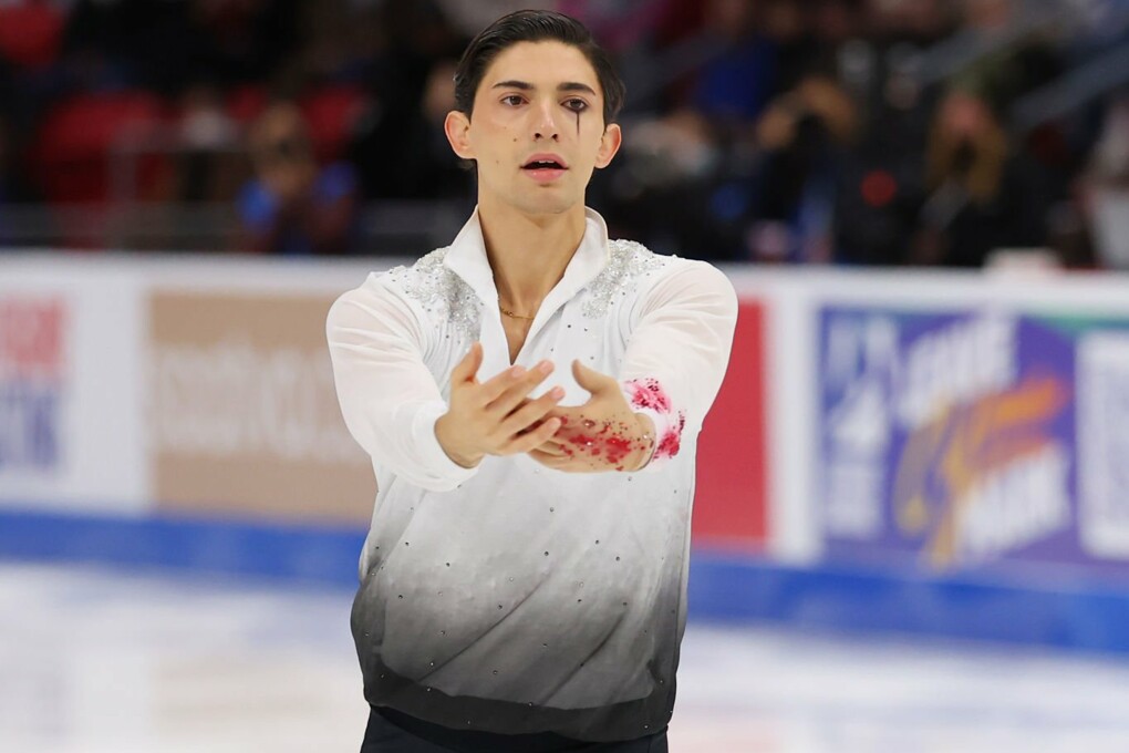 Кори Чирчелли